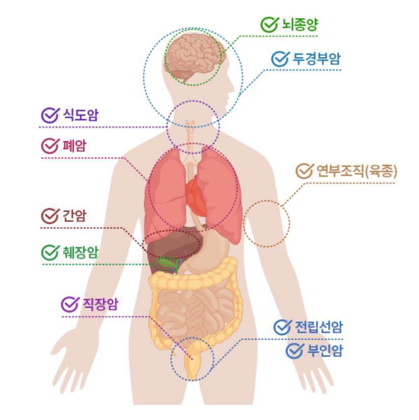 중입자치료기 대상암종